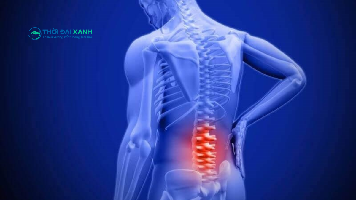 Đau thắt lưng, dấu hiệu nhỏ nhưng cảnh báo lớn về sức khoẻ