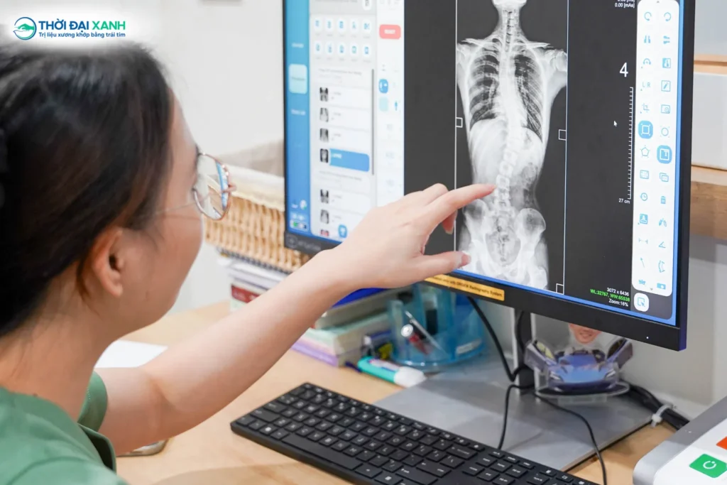 Kết quả phim X-Quang toàn trục của Mạnh cho thấy: cột sống vẹo trái đoạn ngực thắt lưng (T7-L4) với góc lệch lên tới 34,46 độ.
