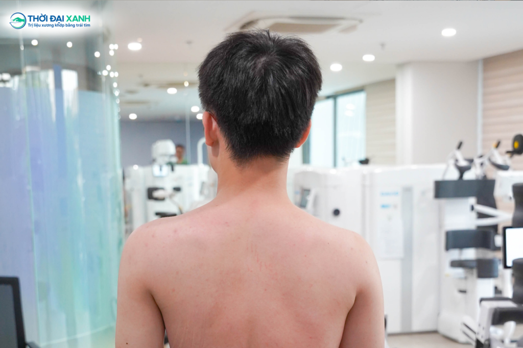 Cong vẹo cột sống không chỉ dừng lại ở sự thay đổi hình thể. Nếu không được can thiệp kịp thời, tình trạng này có thể kéo theo nhiều hệ lụy nghiêm trọng