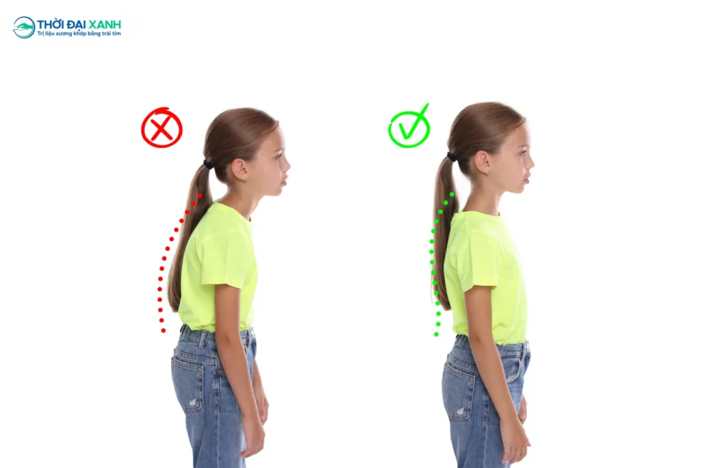 Hoạt động sai tư thế gây ra vẹo cột sống là vấn đề phổ biến nhất ở đối tượng người trẻ tuổi và trẻ em.