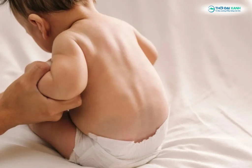 Vẹo cột sống xảy ra do sự bất thường trong quá trình hình thành đốt sống ngay từ khi trẻ còn trong bụng mẹ.