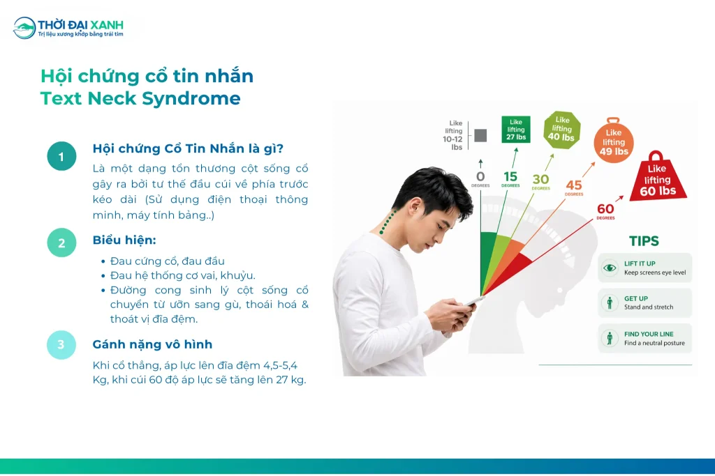 Hội chứng cổ tin nhắn gây ra bởi tư thế cúi đầu về phía trước khi sử dụng các thiết bị điện tử liên tục trong thời gian dài