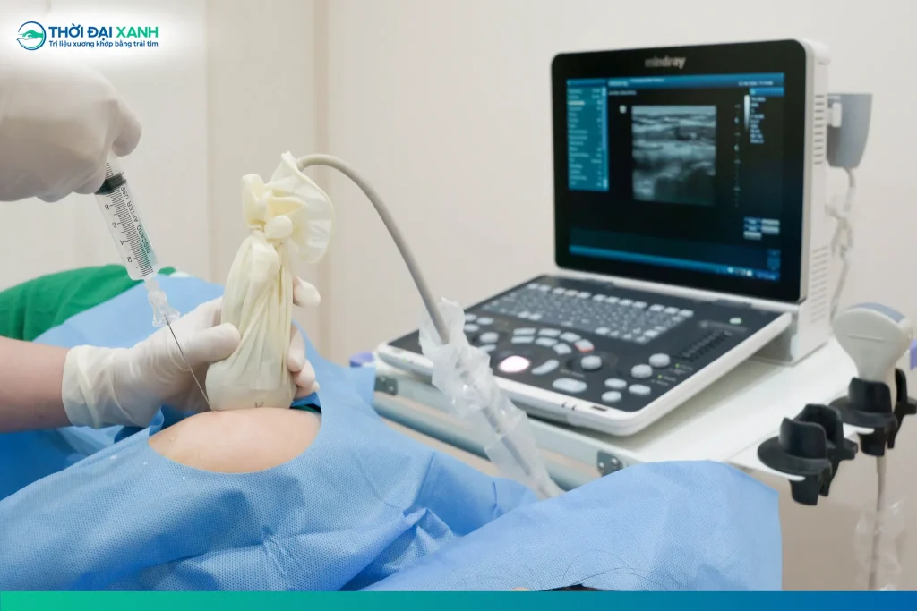 Tiêm nong khớp vai thường được chỉ định trong điều trị viêm quanh khớp vai và dính bao khớp.