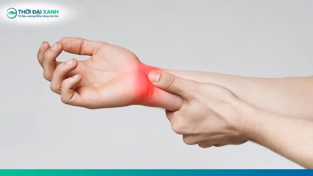Hội chứng ống cổ tay không chỉ gây tê bì, đau nhức các ngón tay mà còn có thể làm suy giảm khả năng cầm nắm nếu kéo dài.