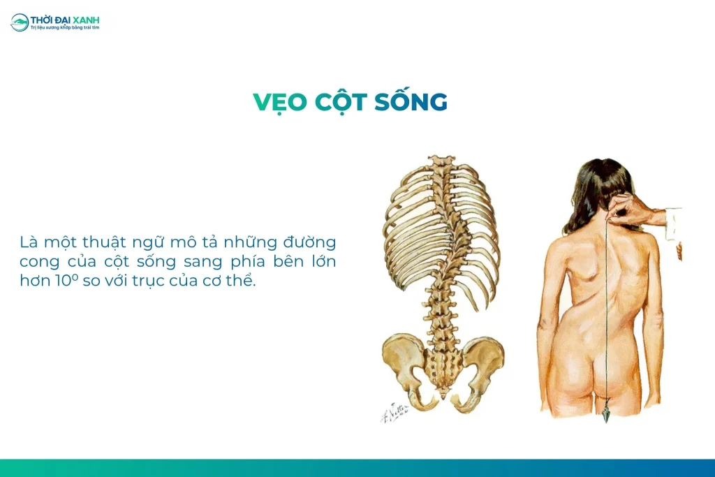 Cong vẹo cột sống tiềm ẩn nhiều hệ lụy nghiêm trọng đến khả năng vận động, hệ hô hấp và chất lượng cuộc sống.