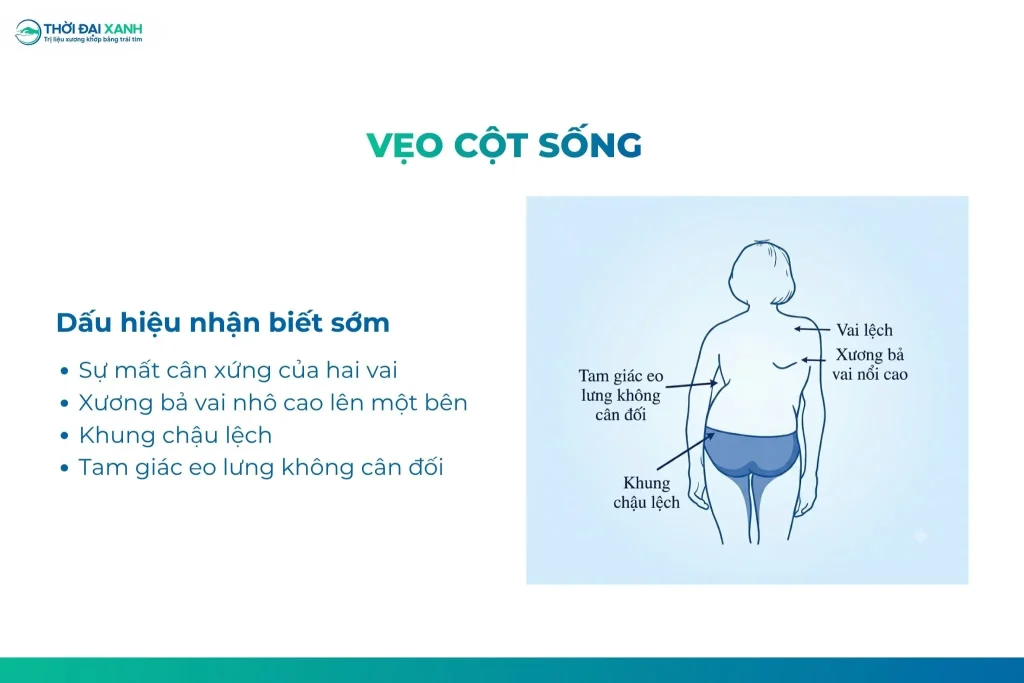 Để nhận biết sớm dấu hiệu cong vẹo cột sống, cần quan sát người bệnh từ phía sau ở tư thế đứng.