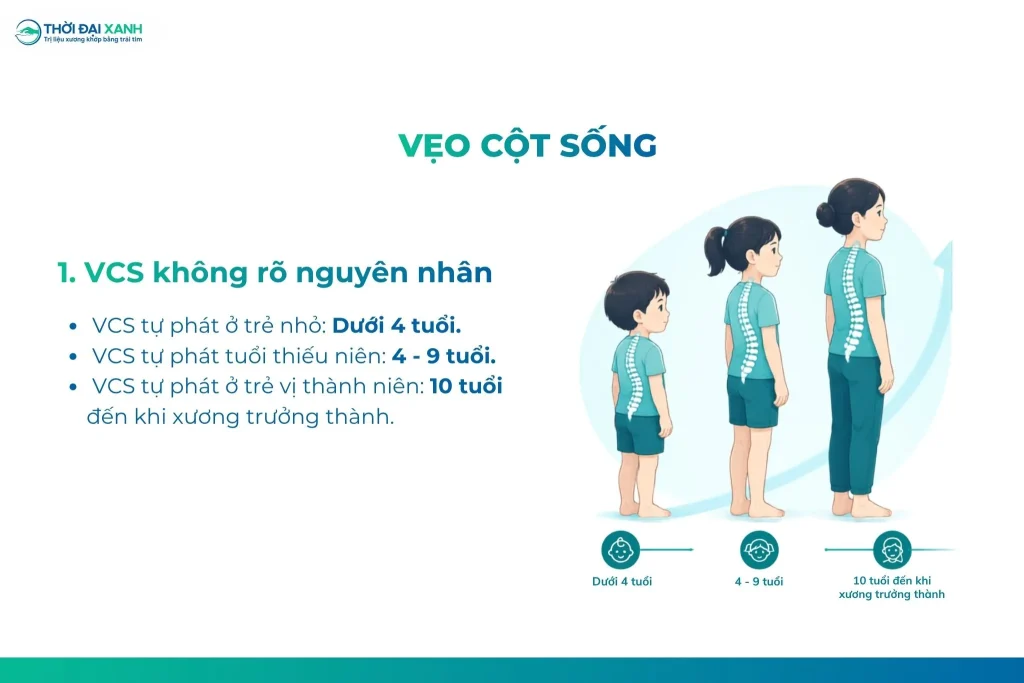 Vẹo cột sống vô căn là dạng cong vẹo cột sống phổ biến nhất, chiếm khoảng 70 đến 80% tổng số trường hợp.
