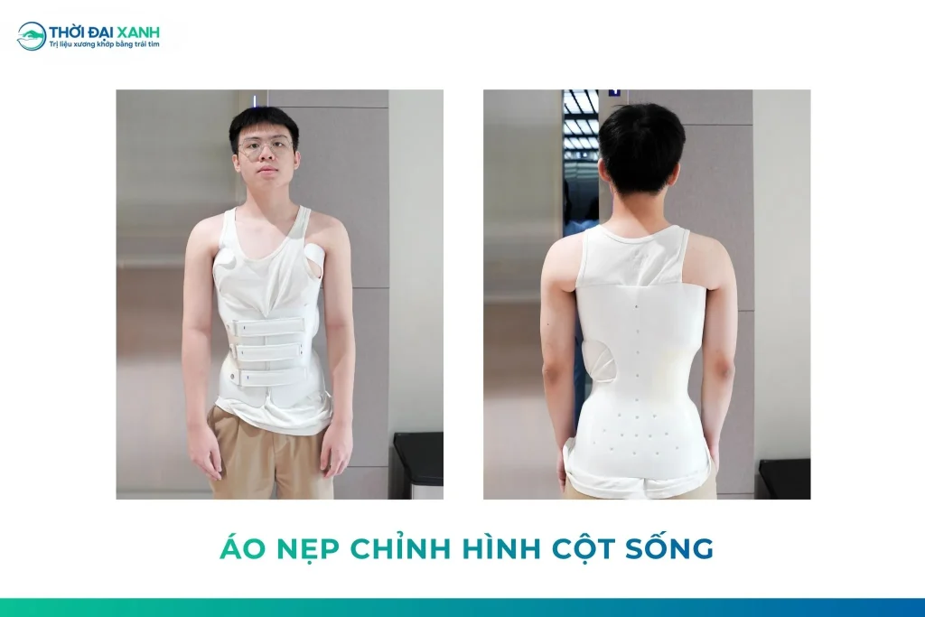 Áo nẹp chỉnh hình được thiết kế cá thể hóa, theo dõi và điều chỉnh theo từng giai đoạn điều trị.