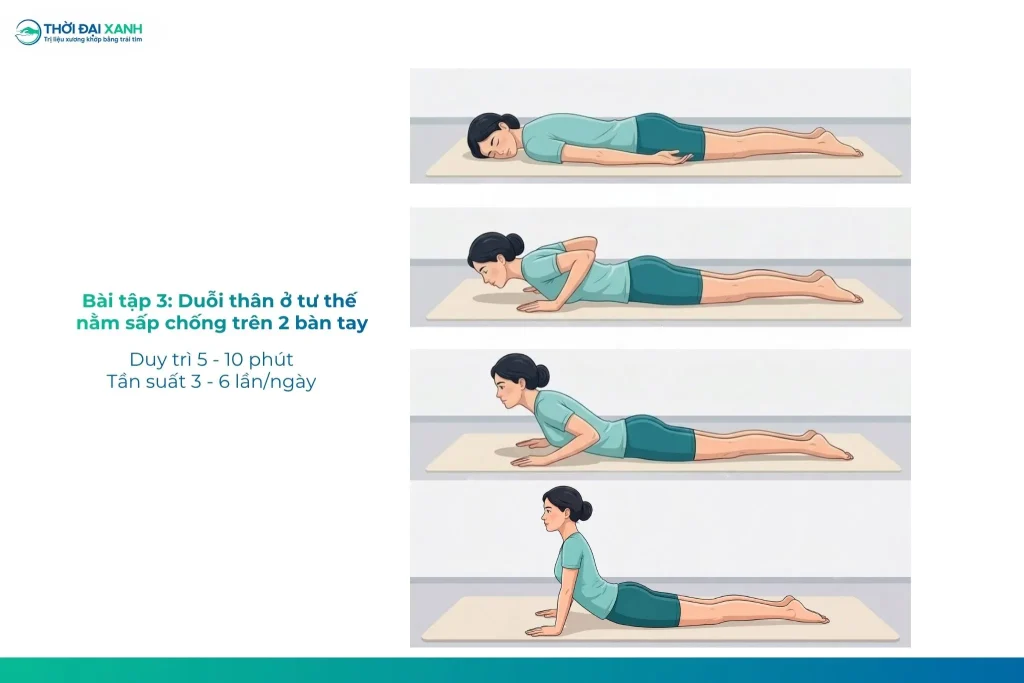 Phương pháp McKenzie - Hình 3. Bài tập duỗi thân ở tư thế nằm chống trên 2 bàn tay 