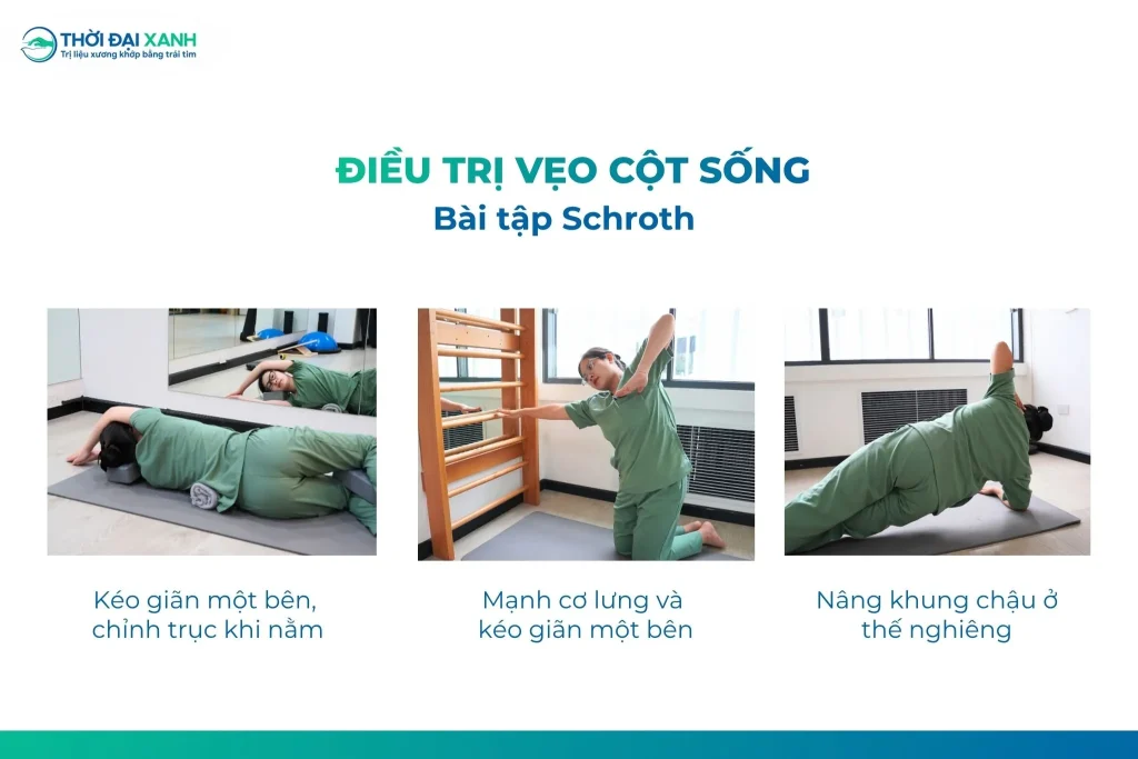 Phương pháp Schroth trong can thiệp vẹo cột sống giúp trẻ rèn luyện khả năng tự điều chỉnh tư thế, kiểm soát thân mình và phối hợp hô hấp.